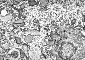 F,28y. | blood … tricholeukocyte v.s. F,28y. | blood … tricholeukocyte v.s.